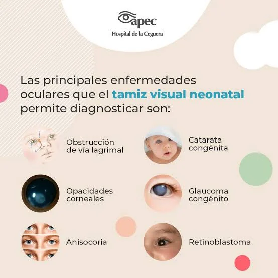 Infografía del Hospital de la Ceguera APEC sobre el tamiz visual neonatal. Se puede ampliar